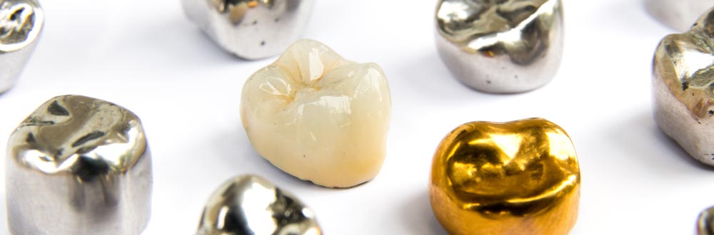 dental crowns